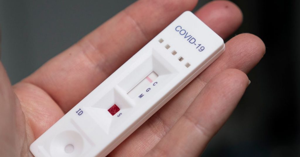 test sierologici coronavirus