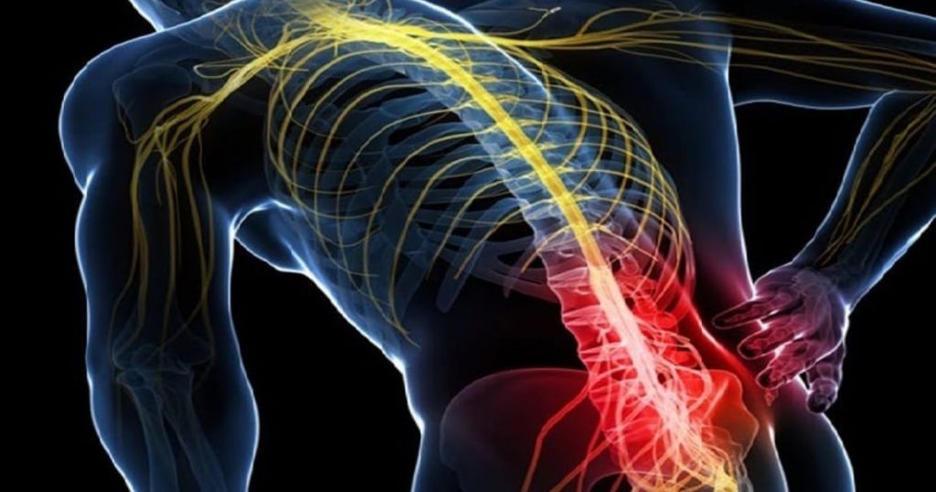 fisioterapia sciatica roma