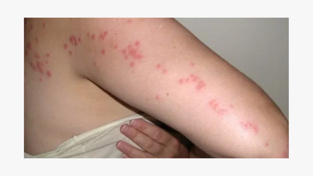 https://www.cimicidalettoroma.it/
