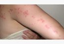https://www.cimicidalettoroma.it/