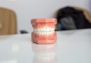 Implantologia dentale per pazienti con poco osso: tecniche e soluzioni avanzate